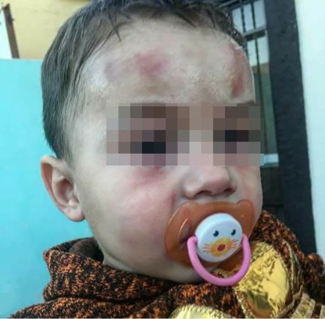 Golpean a bebé en guardería