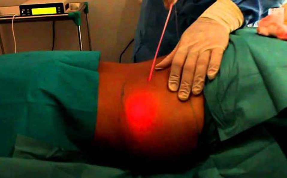Mujer muere tras hacerse la liposucción con un médico sin licencia