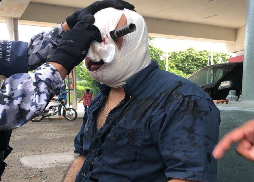 Sin ojo, sale del hospital hombre que protagonizó riña por lugar de estacionamiento