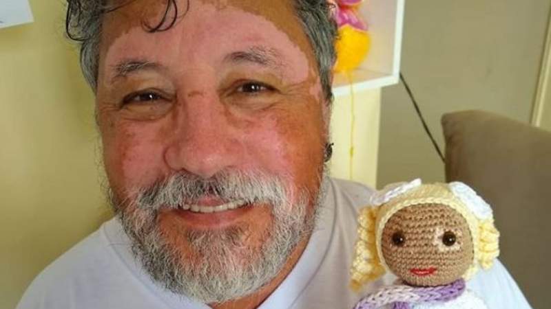 Un abuelo crea muñecas con vitíligo para subir el autoestima de su nieta