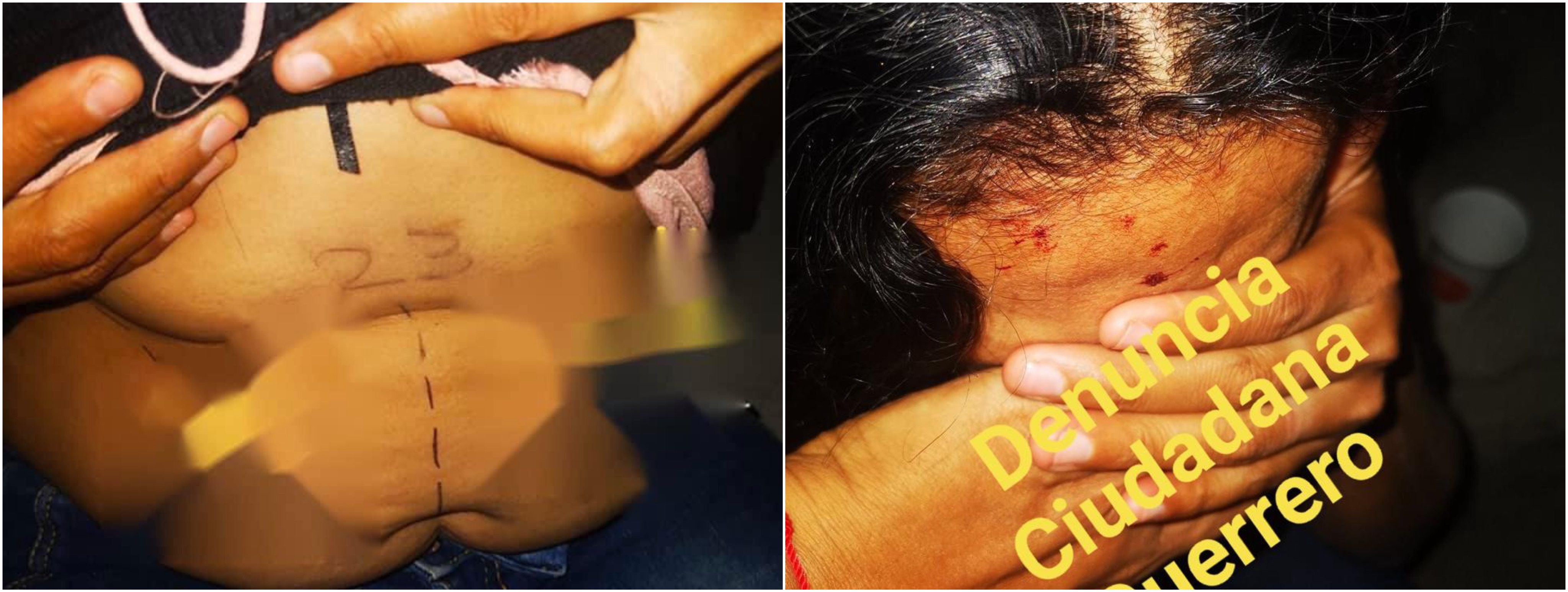 Mujer morelense escapa de SECUESTRADORES en Guerrero, iban a traficar sus órganos