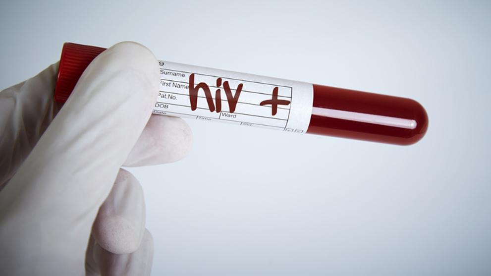 Confirman la CURA del segundo caso de VIH