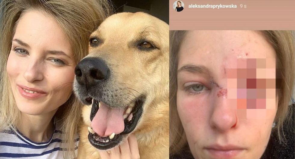 Perro destroza el rostro de una modelo polaca, lo adoptó meses antes