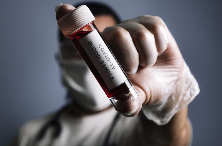 Descubren el tipo de sangre menos propenso a contraer COVID-19
