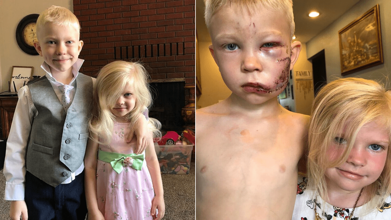 Niño salva a su hermana del ataque de un perro