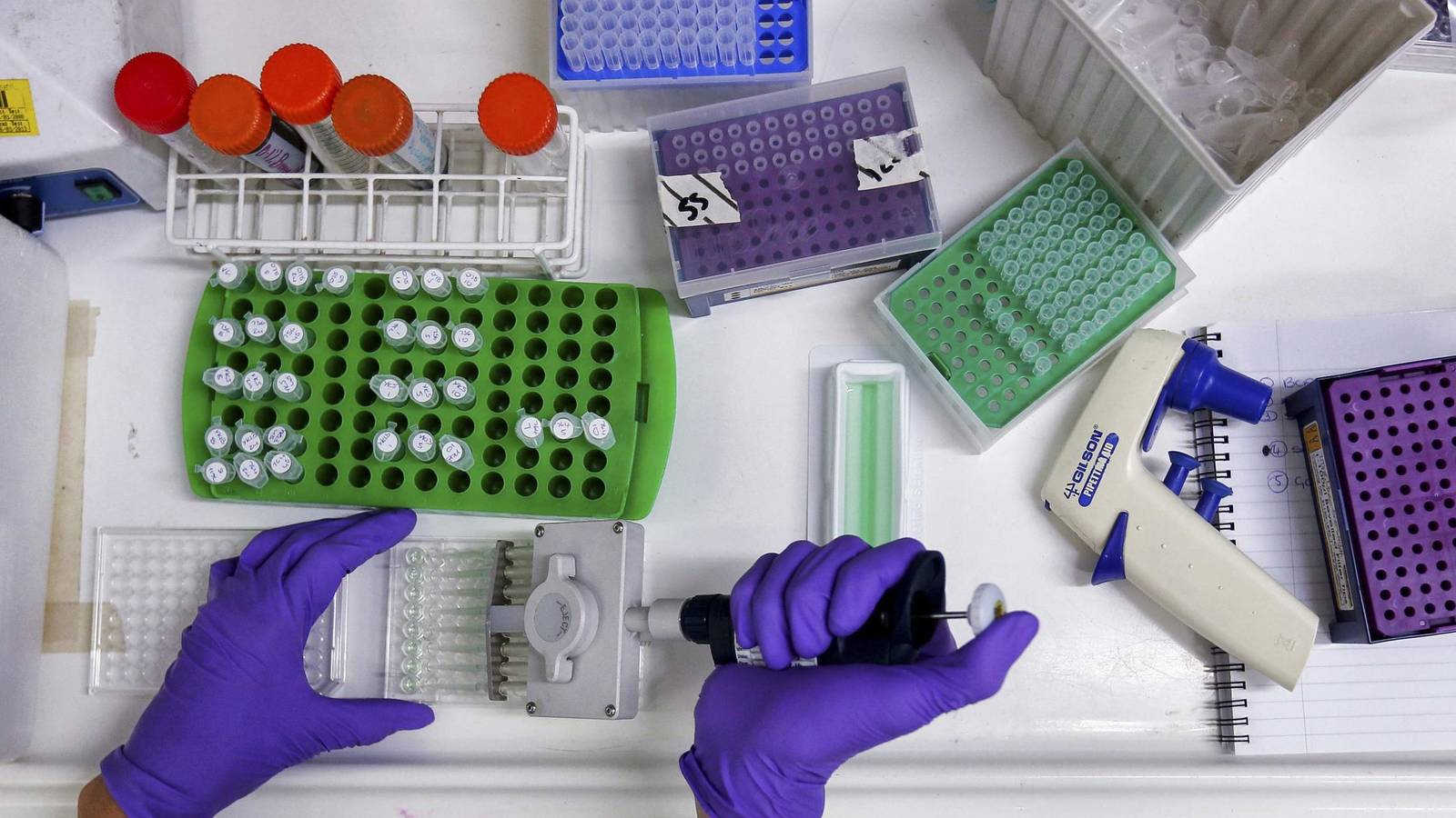 La vacuna contra el COVID-19 desarrollada por AstraZeneca es la más avanzada en el mundo