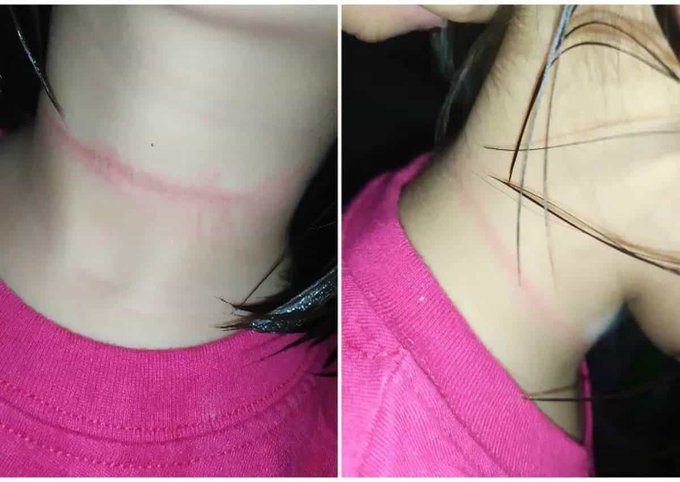 ¡Cuidado! niña intenta colgarse por RETO PELIGROSO de Tik Tok