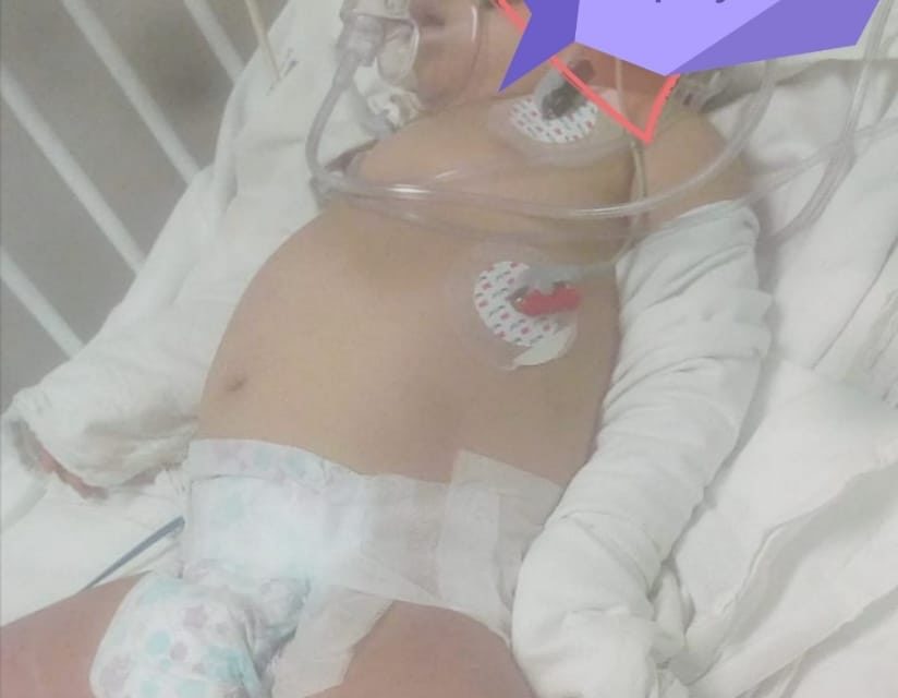 Piden ayuda para bebé con COVID-19 y dengue en Morelos
