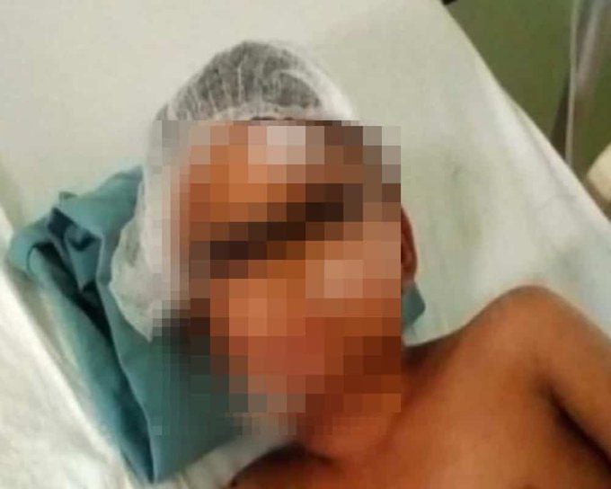 Niño pierde su mano al estallarle cohete que encontró en la calle