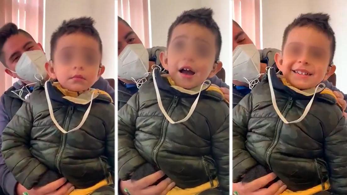 Niño con discapacidad auditiva escucha por primera vez, su reacción es conmovedora