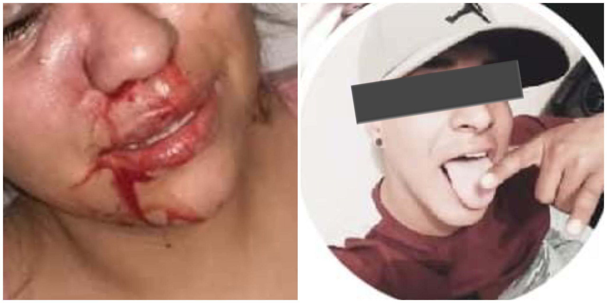 “No quiero estar en la lista de feminicidios” mujer de Jiutepec suplica ayuda ante violencia de su pareja