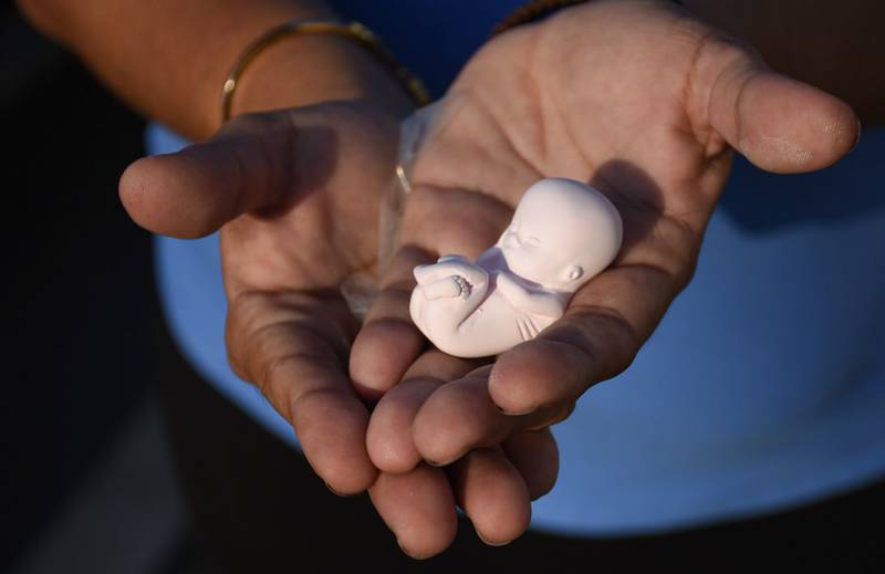 Texas prohíbe el aborto desde la semana 6 de gestación