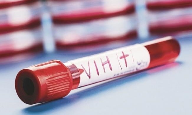VIH cura mujer células madre