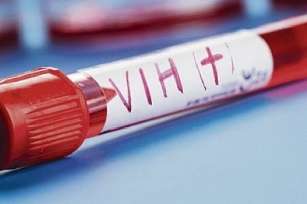 Las personas con VIH deben vacunarse contra la COVID-19