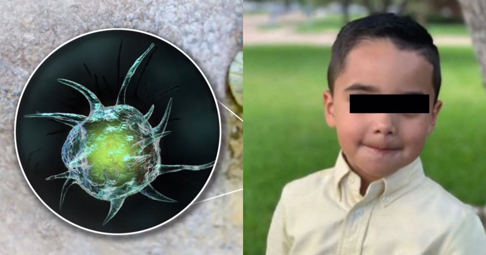 Niño muere por “ameba come cerebros” tras visitar un parque en EE.UU