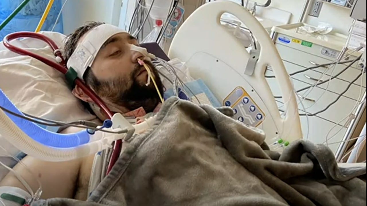 Joven que se negaba a vacunarse contra la COVID-19 recibió doble trasplante pulmonar
