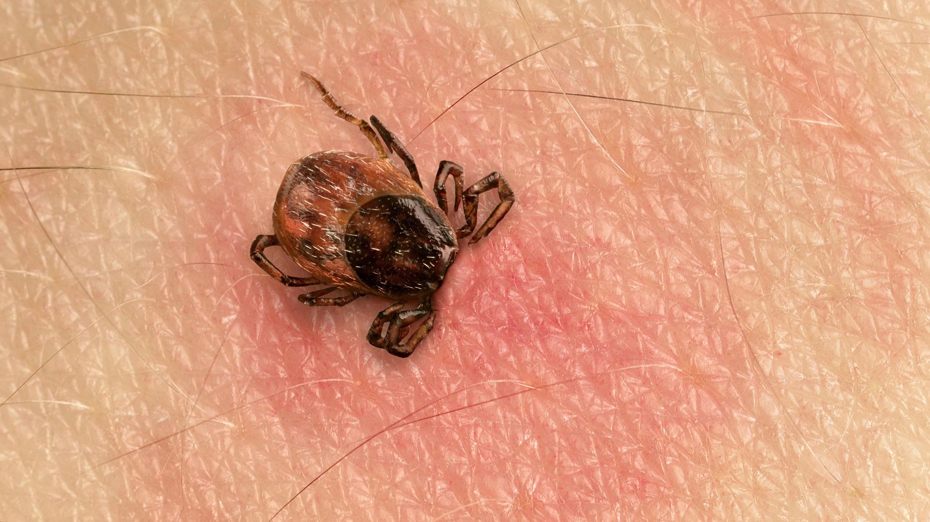 Descubren una nueva enfermedad que transmiten garrapatas a humanos