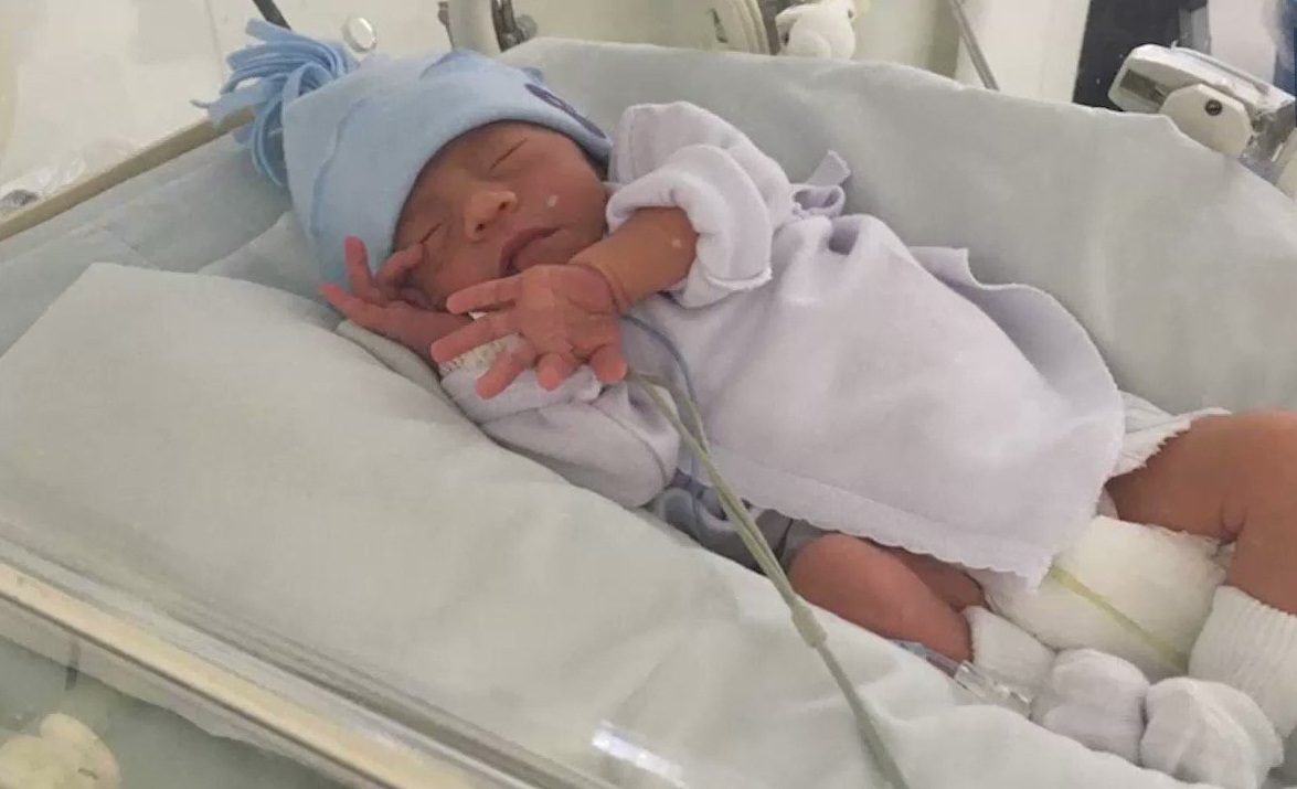 Bebé se aferra a la vida con una sonrisa
