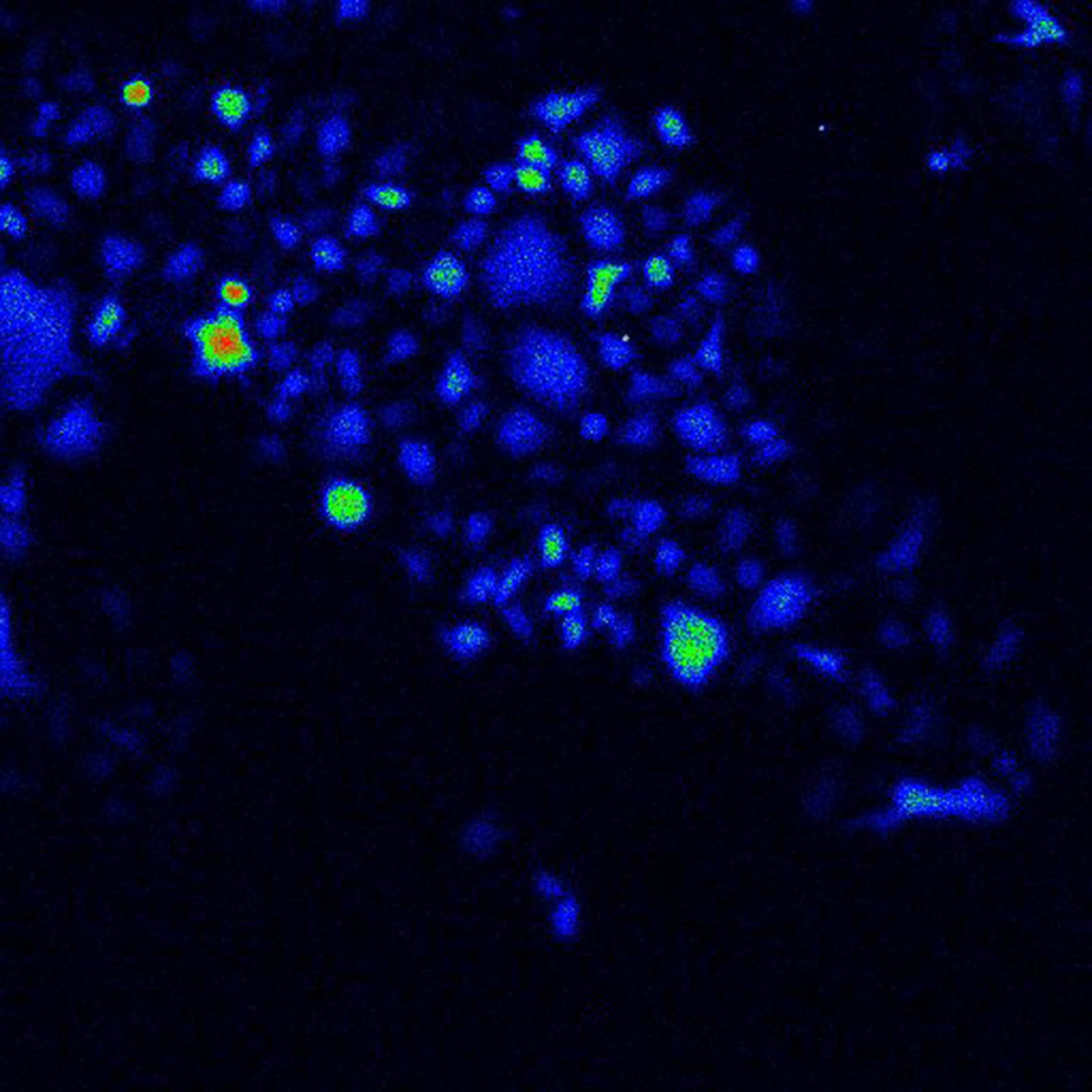 Especialistas de la UNAM analizan el uso de la bioluminiscencia para combatir el cáncer