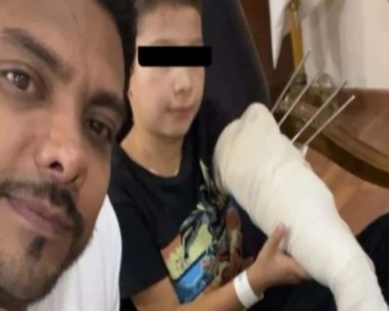 Niño atacado por lobo en zoológico de Nezahualcóyotl relata su historia