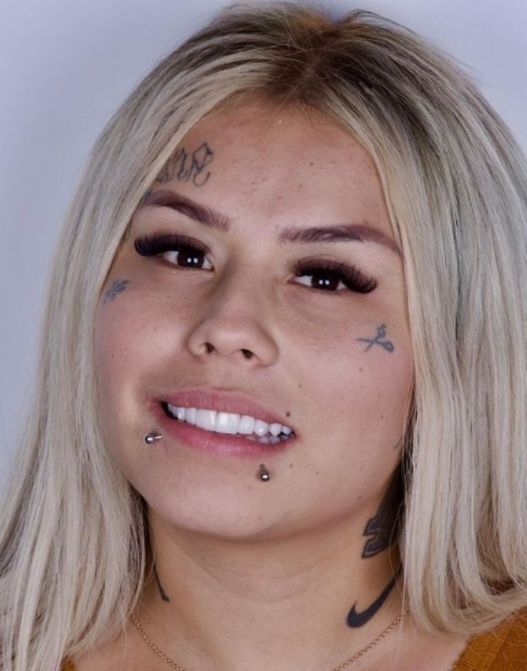 sonrisa con diamantes