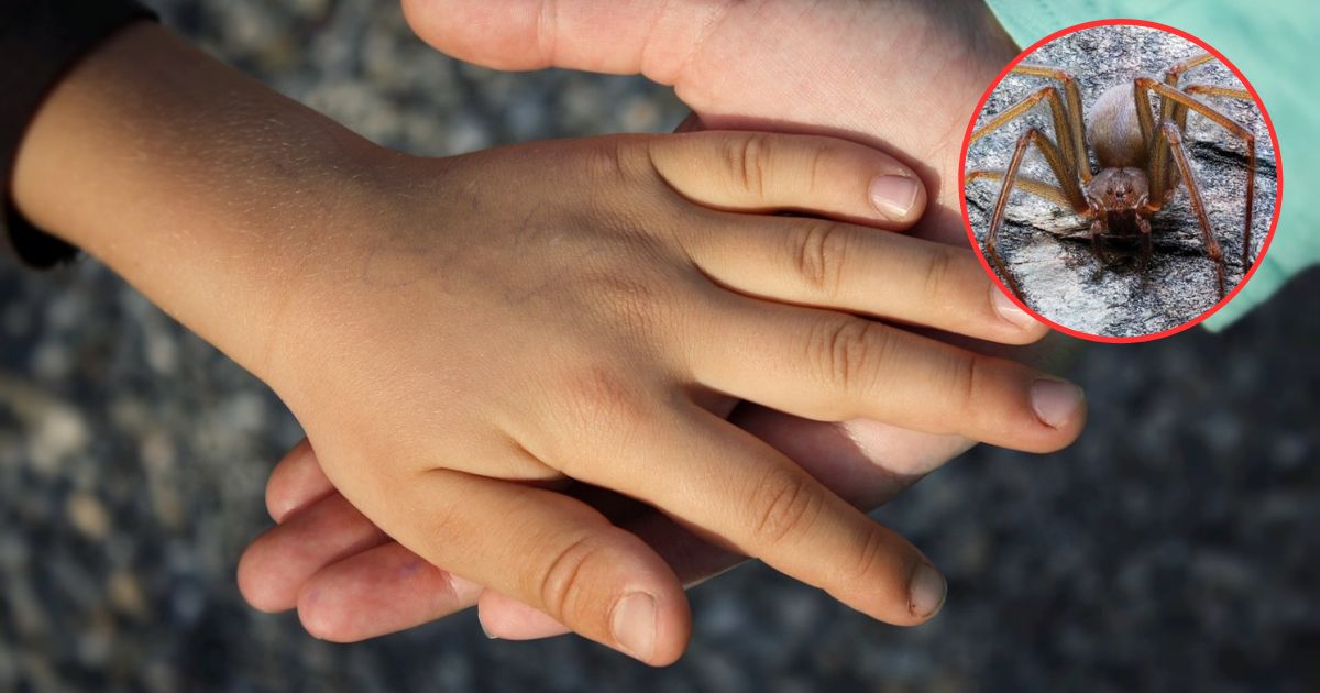 Niño es picado por araña y la clínica pedía 30 mil pesos por antídoto