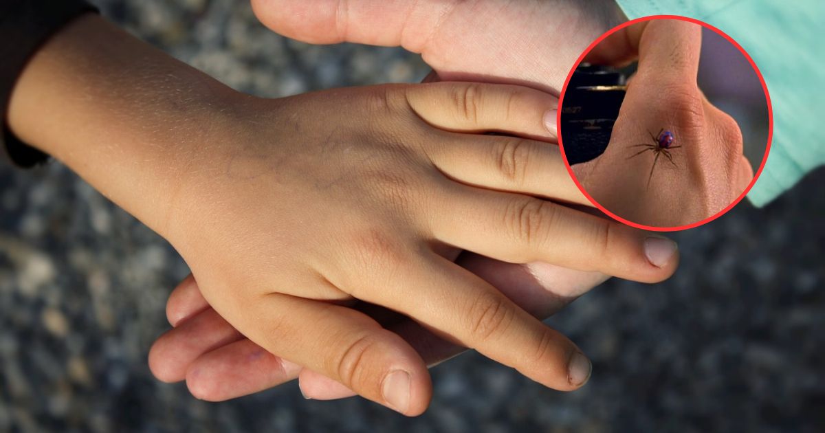 Niño es mordido por una viuda negra tras querer “convertirse” en Spider-man