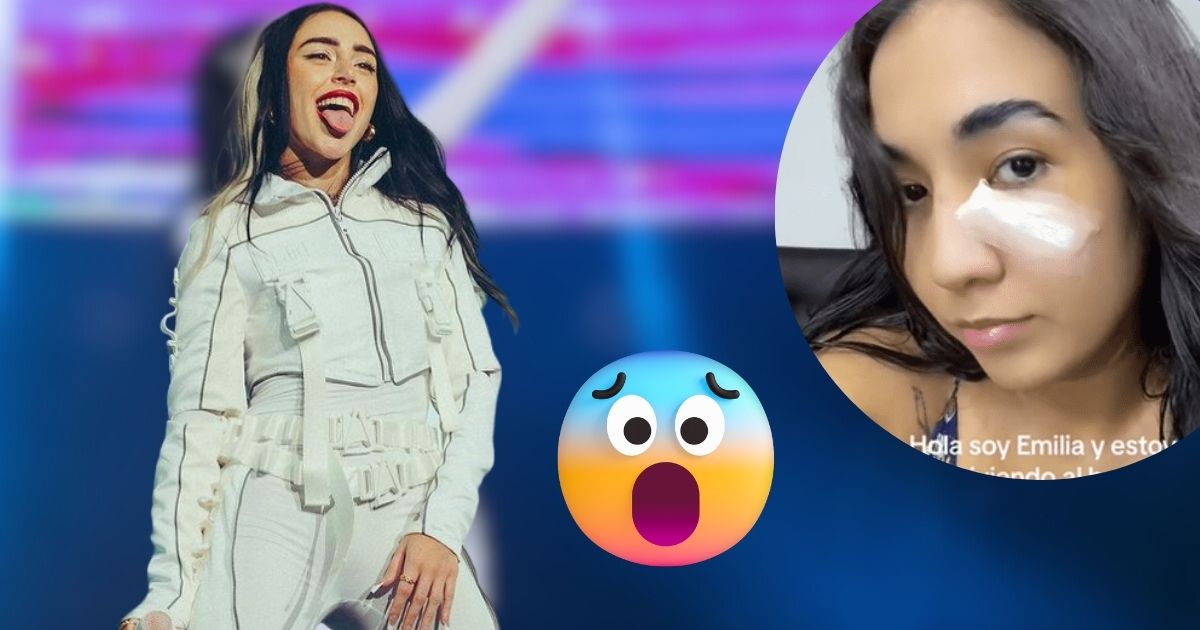 Mujer acusa a Nicki Nicole de golpearle la cara con una botella
