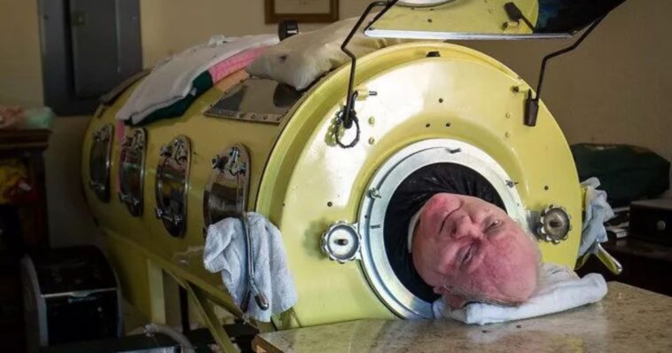 Muere Paul Alexander