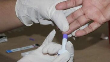 ¿Cómo funcionan las autopruebas de VIH?