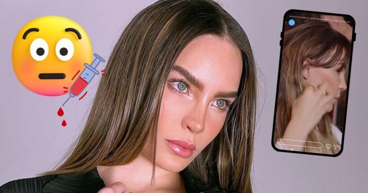 Belinda estiramiento facial