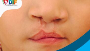 Cirugias gratuitas labio