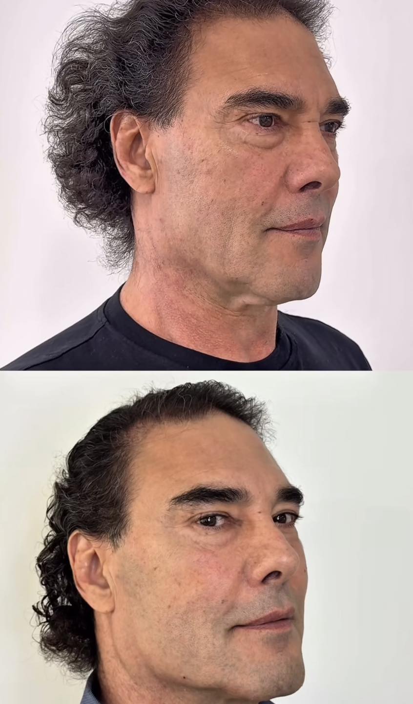eduardo yañez rostro