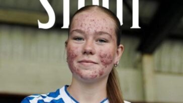 Fútbol unido para apoyar a Skye Stout tras acoso