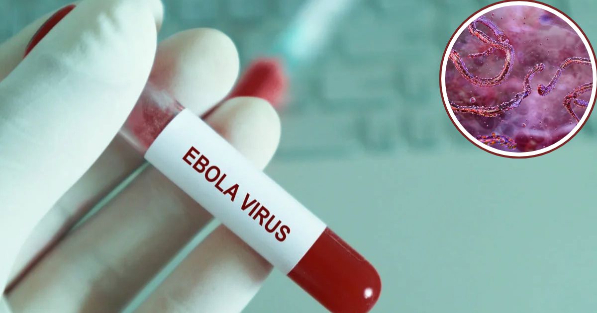 Virus Ébola